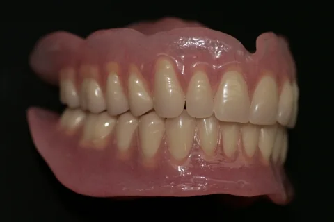 A full upper and lower denture photographed on black