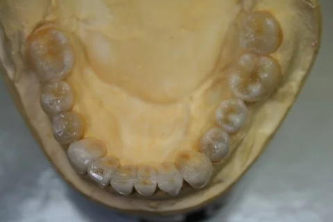 Diagnostic wax up. Lower occlusal